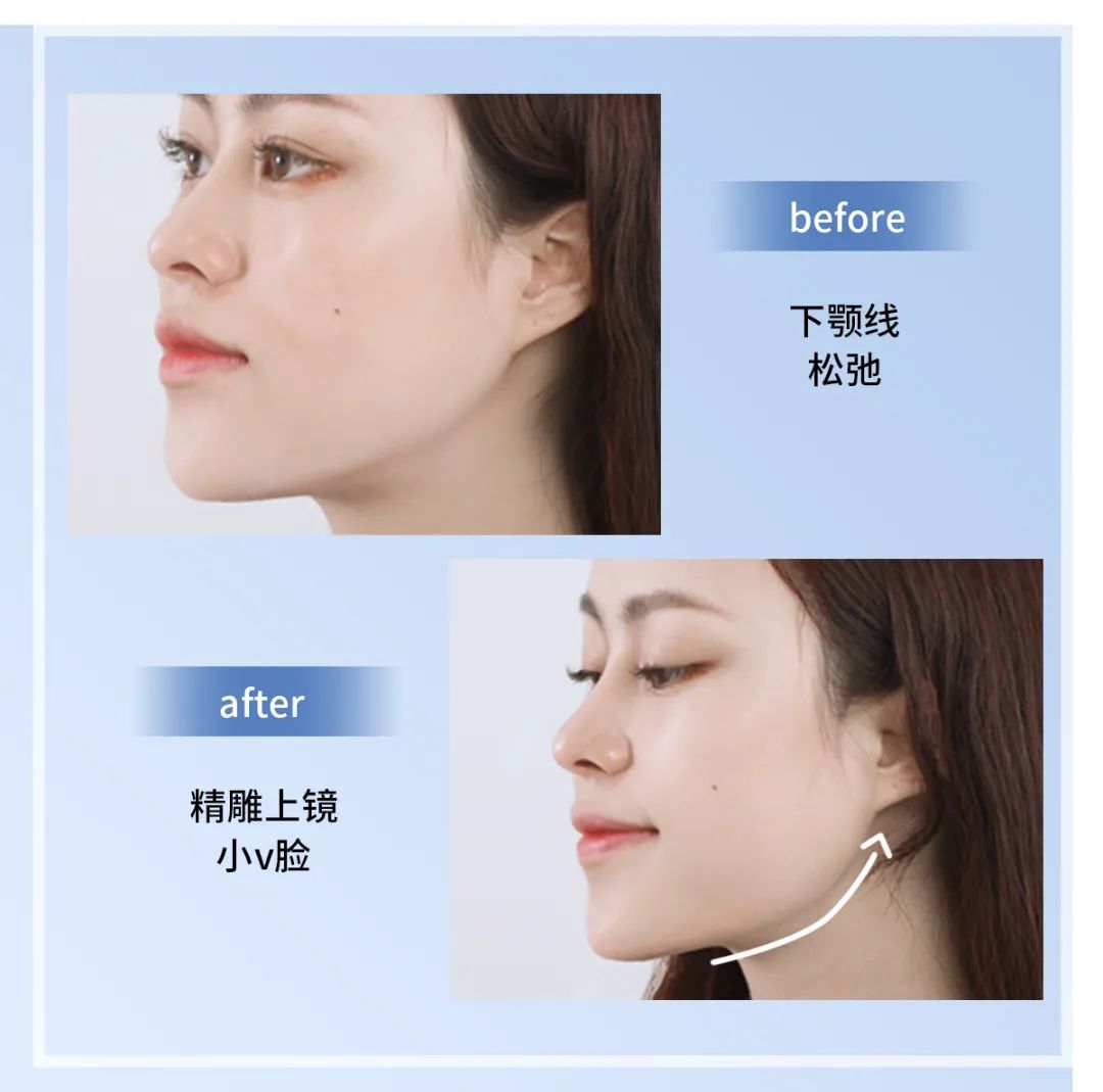 欧瑞莲 欧瑞莲